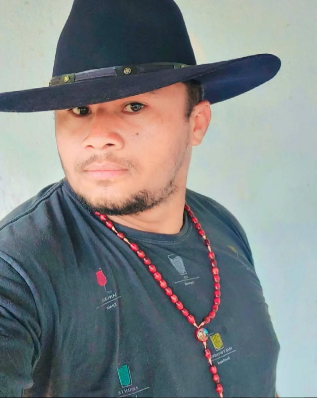 QUEBROU A CARA - MUSICA